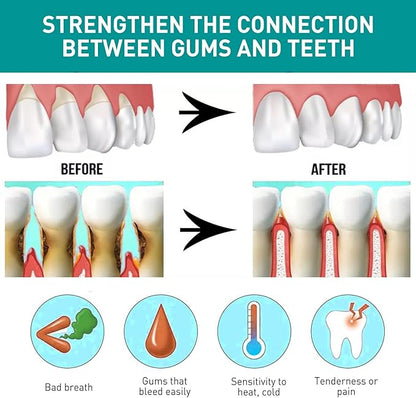 Eelhoe - Mouth Relief Spray (Original) - 25ml