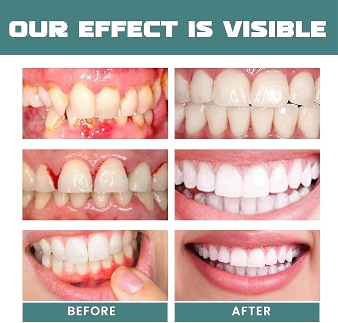 Eelhoe - Mouth Relief Spray (Original) - 25ml